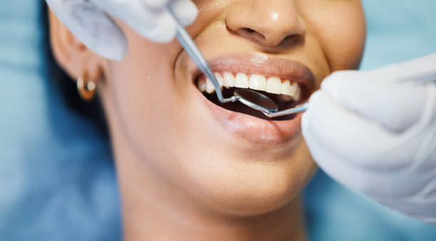 Best Emergency Dental Care for Broken or Chipped Teeth in Bal Harbour, FL
