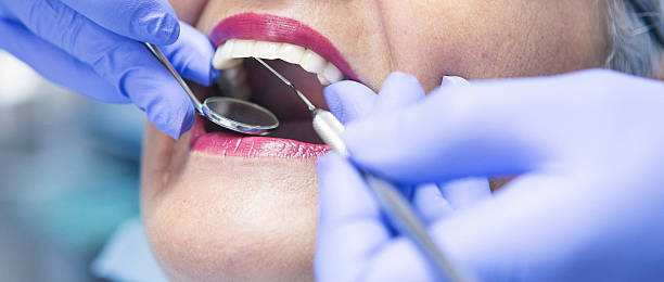 Best Emergency Treatment for Dental Infections or Abscesses in Bal Harbour, FL